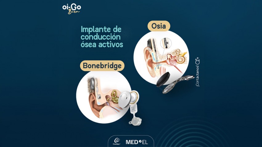 Implante de conducción ósea