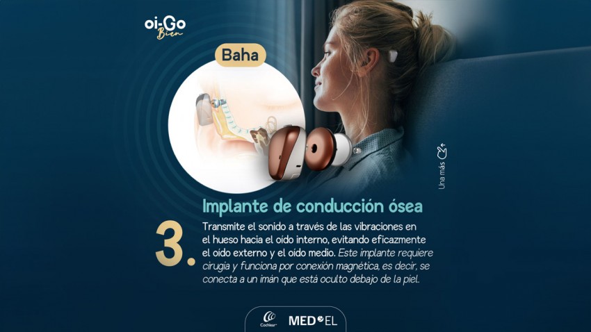 Implante de conducción ósea
